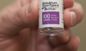 botox
