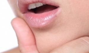 herpes