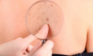 Dermatológ