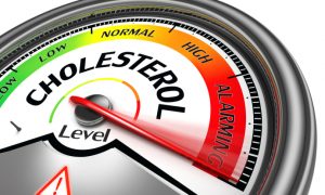Cholesterol