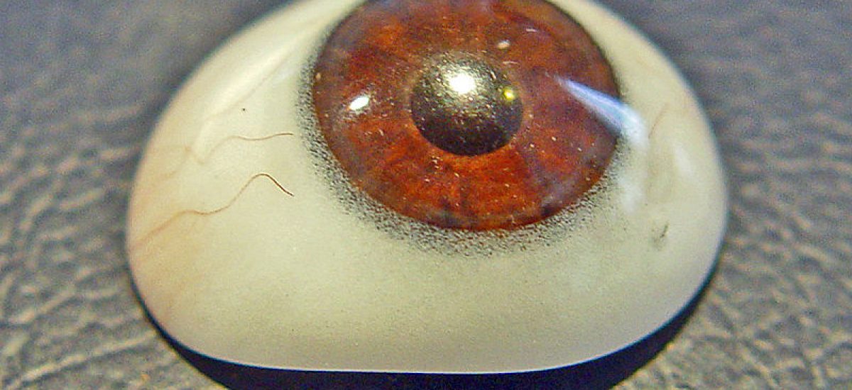 Očná protéza