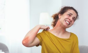 Alergia