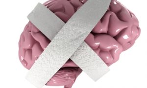 Alzheimer