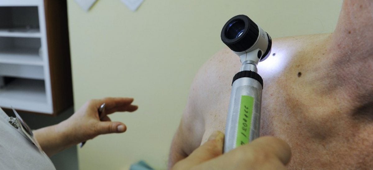 Vyšetrenie znamienok dermatoskopom