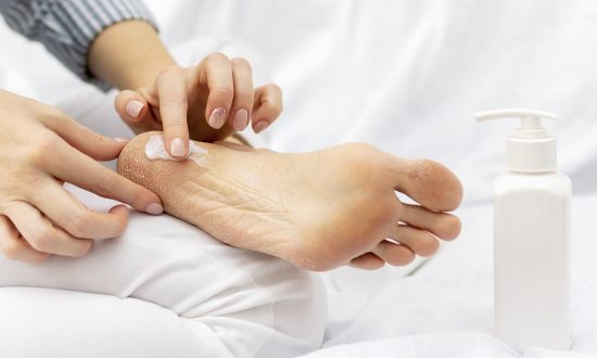 Popraskané päty trápia mnoho žien a nejde len o estetický problém