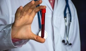 doktor drží ampulku krvi