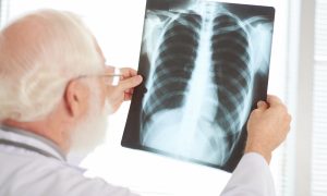 doktor a rontgen pľúc