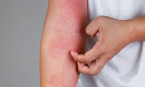 Koža je zrkadlom nášho zdravia a odhalí nám množstvo chorôb
