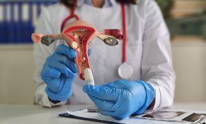 gynekologička ženské reprodukčné orgány