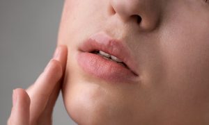 mladá žena lieči boľavý herpes na perách